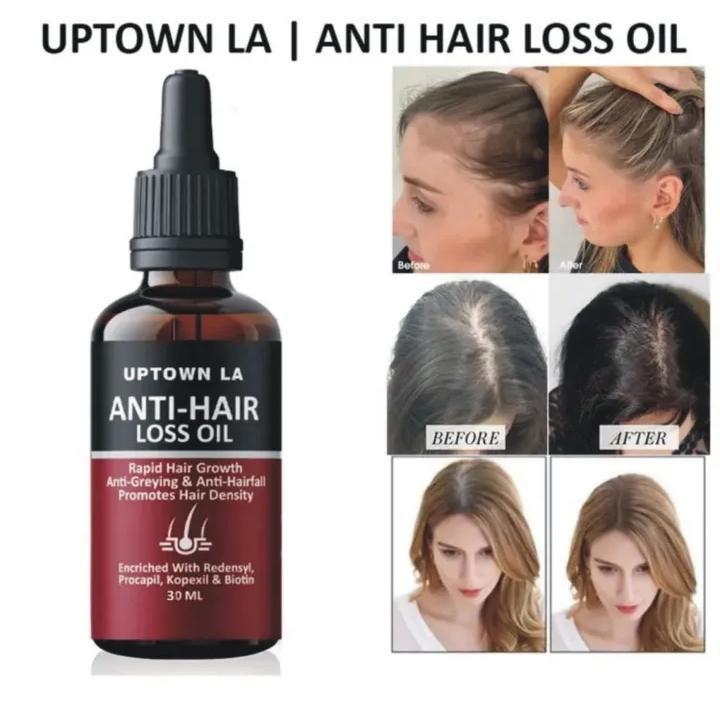 Uptown La Anti-Hair Fall Hair Oil